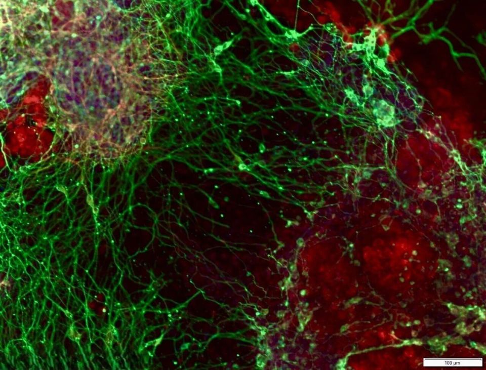 脑机接口与AI协同 过去一周脑科学与网络技术研究新进展